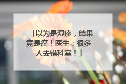 以为是湿疹，结果竟是癌！医生：很多人去错科室！
